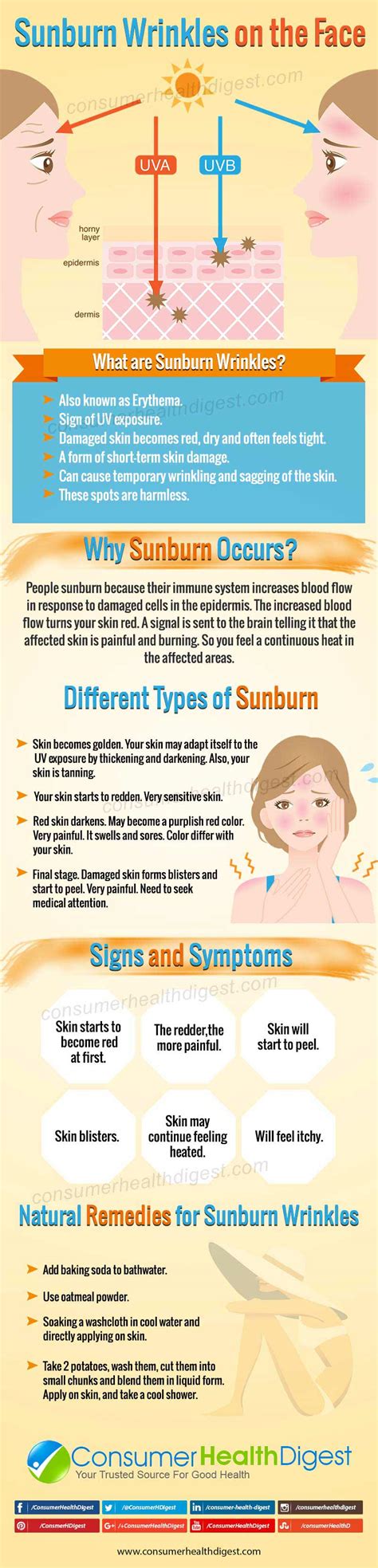 Sunburn Wrinkles Types Causes Symptoms Remedies And Treatments