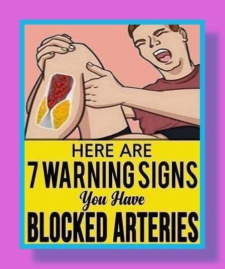 6 Signs That Indicate You Have Blocked Arteries In 2022 Arteries