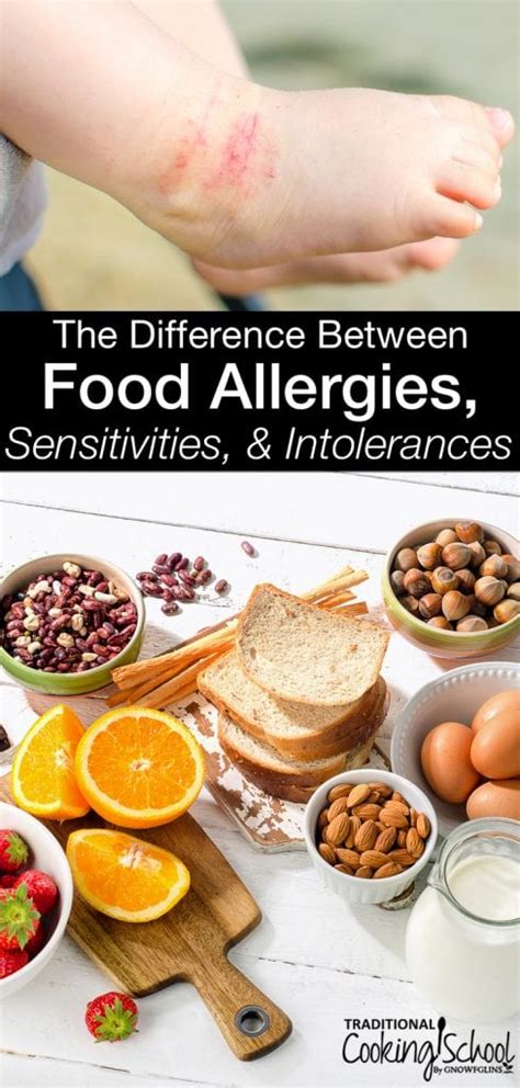The Difference Between Food Allergies Sensitivities And Intolerances