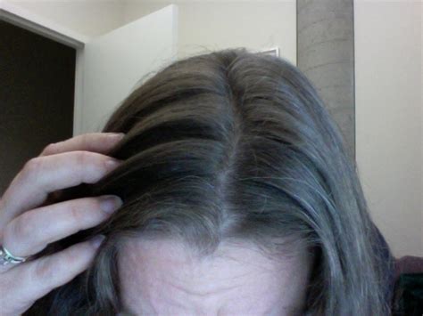 Causes Of Grey Hair At An Early Age