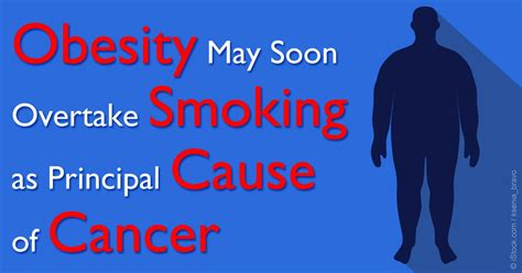 Obesity Will Soon Overtake Smoking As Principal Cause Of Cancer