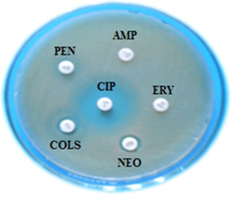 Antibiogram Profiles Of E Coli Against Ampicillin Amp Penicillin