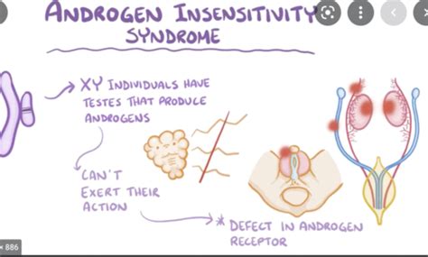 Androgen Insensitivity Syndrome Flashcards Quizlet