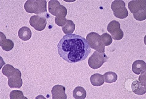 Monocyte 1