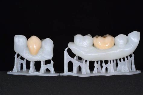3d Printed Teeth For Reference Models In Dental Formlabs Dental