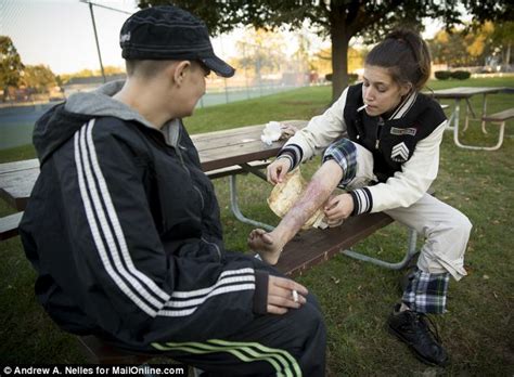 krokodil drug 2 more cases of suspected in us daily mail online
