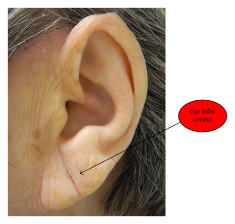 Ear Lobe Liberal Dictionary