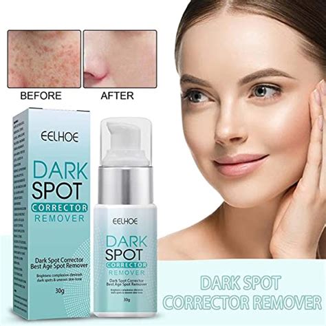 3pack Musely Dark Spot Creamthe Spot Cream For Facedark Spot Correct Cream Freckle Remover