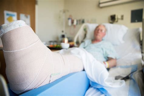Elderly Population Faces Increased Risk Of Death From A Broken Bone Merkel And Cocke Pa