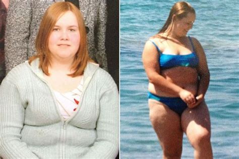 Obese Woman Who Weighs Stone Turned To Comfort Food After She Was