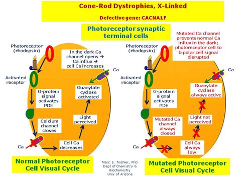 Cone Rod Dystrophies X Linked Hereditary Ocular Diseases
