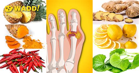 Wadd Foods That Prevent Gout Attacks