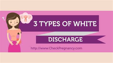 Shades Of White Types Of Vaginal Discharge Infographic