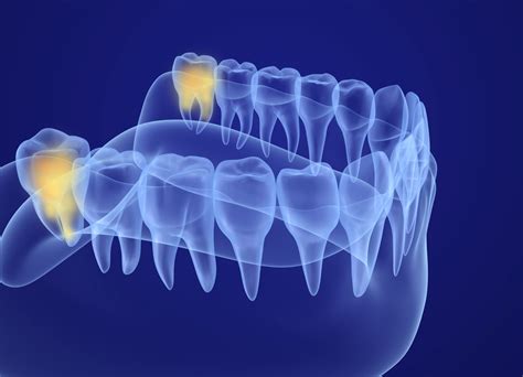 The Significance Of Molar Teeth Wisdom Teeth Function