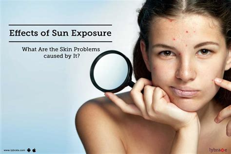 Effects Of Sun Exposure What Are The Skin Problems Caused By It By