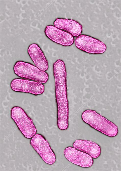 Escherichia Coli Bacteriatem Stock Image C0129924 Science Photo