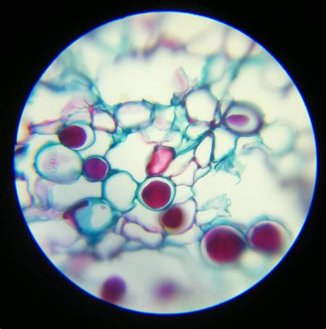 Saxon Prodigy Mk Ii Biological Microscope 40x 1600x