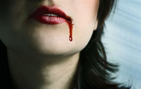 Причины виды кровотечения изо рта у человека почему течет кровь изо