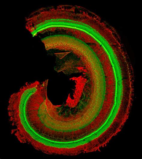 Sound Receptor Hair Cells Bright Green In The Inner Ear Cochlea Of