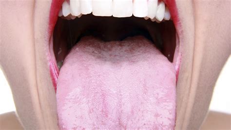Hpv Mouth