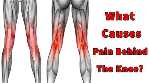 Pin on What Causes Pain Behind The Knee Pain Behind Knee - Aza Food For ...