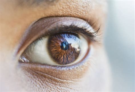 What Is Glassy Eyes Disease Causes And Prevention Where Wellness And Culture