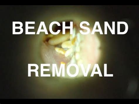 How To Get Sand Out Of Ear Arciniega Seents
