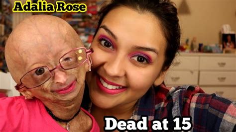Progeria Advocate Adalia Rose Dead At 15 Rip Adalia Rose Youtube