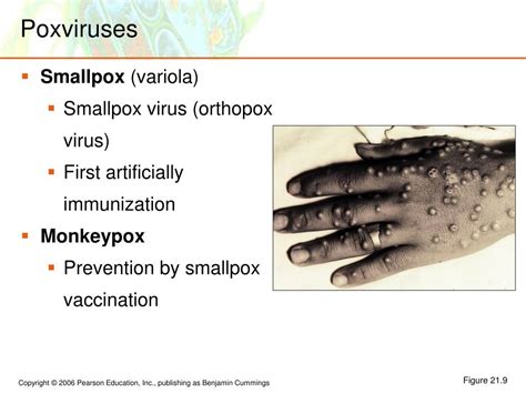 Ppt Microbial Diseases Of The Skin And Eyes Powerpoint Presentation