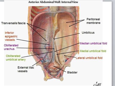 Urachus Median Umbilical Ligament
