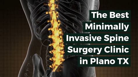 The Best Minimally Invasive Spine Surgery Clinic In Plano Tx Dr Scott