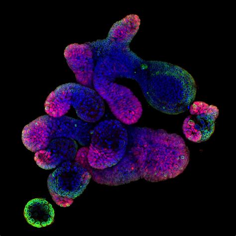How Brain Organoids Are Transforming Research The Niche