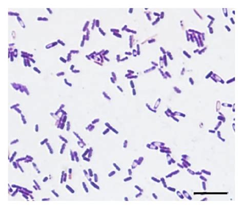 Gram Positive Bacilli Images Galleries With A Bite