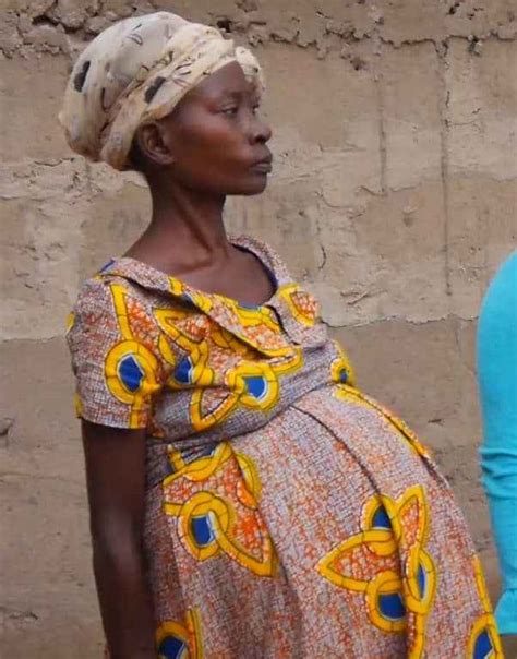 Shocker Woman Pregnant For 13 Years But What She Got Removed From Her Belly Will Shock You