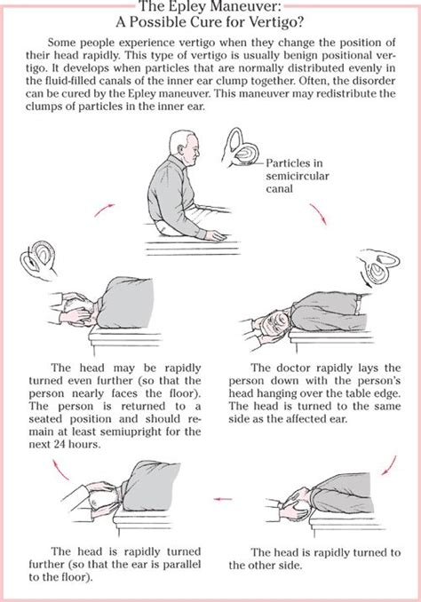 Pin By Miroslawa Bodnar On Pa Epley Maneuver Medical Massage