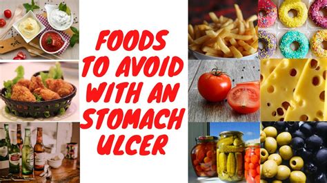 Foods To Avoid With An Stomach Ulcer YouTube