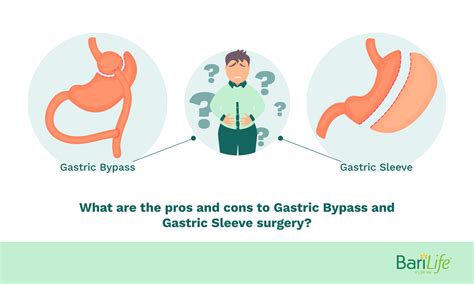 Gastric Sleeve Vs Gastric Bypass What Are The Pros And Cons
