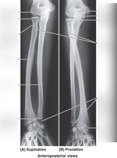 X Ray Anatomy Forearm Diagram Quizlet