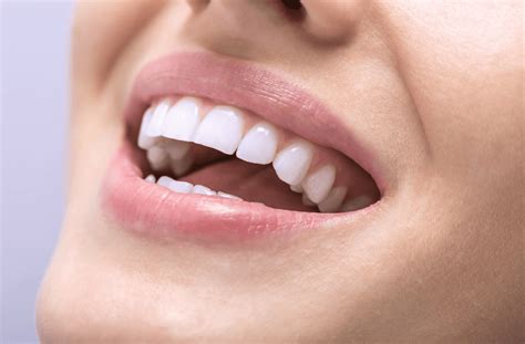 Gula Tänder Behandla Och Förebygg Missfärgade Tänder