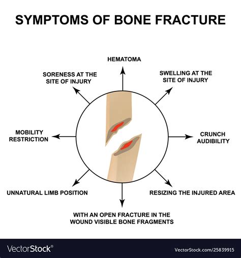 Guide To Bone Fractures Bone Fracture Fractures Fracture Symptoms