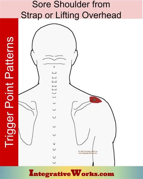 Sore Shoulder From Strap Or Lifting Overhead Integrative Works