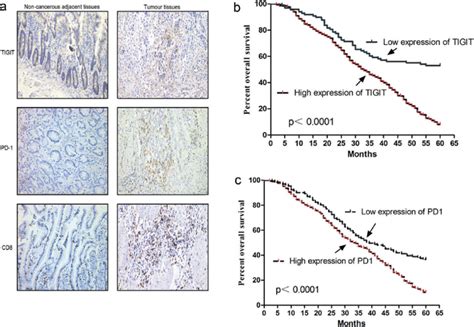TIGIT And PD 1 Expression In GC Patients A Immunohistochemistry