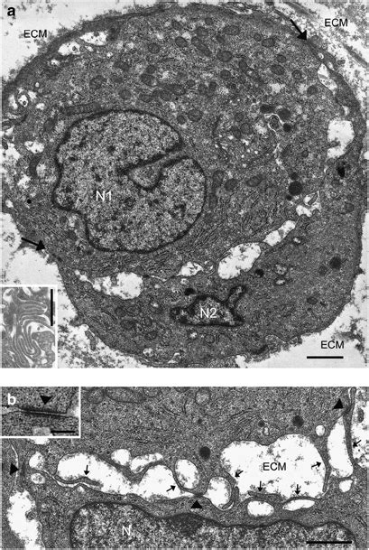 Electron Micrographs Of Cross Sections Of Adjacent Cell Borders In An