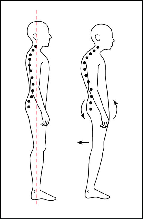 Illustration Showing The Conventional Standing Position Posture And