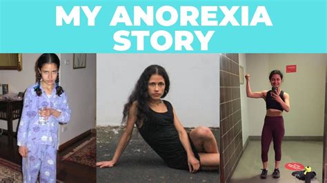 My Anorexia Story With Pictures Youtube