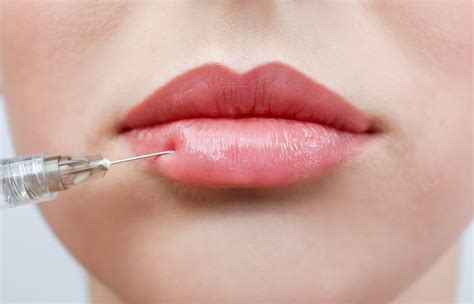 Comparing Different Dermal Fillers National Laser Institute Medical Spa