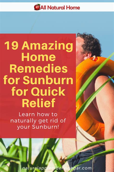 19 Amazing Home Remedies For Sunburn For Quick Relief All Natural