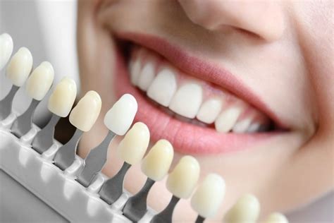 A Pro Guide To Cosmetic Dentistry Treatments