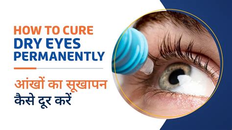 Dry Eyes Treatment And Home Remedies In Hindi How To Cure Dry Eyes