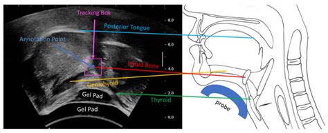 Sensors Free Full Text Automatic Hyoid Bone Tracking In Real Time
